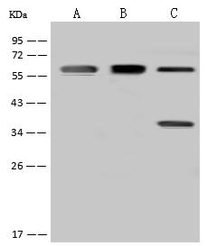 FBXO7 Antibody - Anti-FBXO7 rabbit polyclonal antibody at 1:500 dilution. Lane A: MCF7 Whole Cell Lysate. Lane B: HL-60 Whole Cell Lysate. Lane C: U-251 MG Whole Cell Lysate. Lysates/proteins at 30 ug per lane. Secondary: Goat Anti-Rabbit IgG (H+L)/HRP at 1/10000 dilution. Developed using the ECL technique. Performed under reducing conditions. Predicted band size: 59 kDa. Observed band size: 59 kDa.