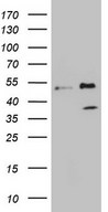 FBXO8 / FBX8 Antibody - HEK293T cells were transfected with the pCMV6-ENTRY control (Left lane) or pCMV6-ENTRY FBXO8 (Right lane) cDNA for 48 hrs and lysed. Equivalent amounts of cell lysates (5 ug per lane) were separated by SDS-PAGE and immunoblotted with anti-FBXO8 (1:2000).