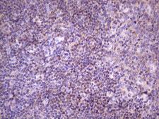 FBXO8 / FBX8 Antibody - IHC of paraffin-embedded Human lymph node tissue using anti-FBXO8 mouse monoclonal antibody. (Heat-induced epitope retrieval by 1 mM EDTA in 10mM Tris, pH8.5, 120°C for 3min)(1:150).