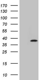 FBXO8 / FBX8 Antibody - HEK293T cells were transfected with the pCMV6-ENTRY control (Left lane) or pCMV6-ENTRY FBXO8 (Right lane) cDNA for 48 hrs and lysed. Equivalent amounts of cell lysates (5 ug per lane) were separated by SDS-PAGE and immunoblotted with anti-FBXO8 (1:2000).