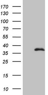 FBXO8 / FBX8 Antibody - HEK293T cells were transfected with the pCMV6-ENTRY control (Left lane) or pCMV6-ENTRY FBXO8 (Right lane) cDNA for 48 hrs and lysed. Equivalent amounts of cell lysates (5 ug per lane) were separated by SDS-PAGE and immunoblotted with anti-FBXO8.