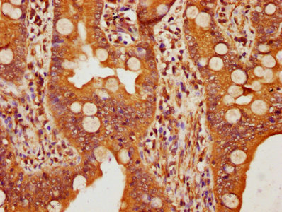 FBXW11 Antibody - IHC image of FBXW11 Antibody diluted at 1:109 and staining in paraffin-embedded human small intestine tissue performed on a Leica BondTM system. After dewaxing and hydration, antigen retrieval was mediated by high pressure in a citrate buffer (pH 6.0). Section was blocked with 10% normal goat serum 30min at RT. Then primary antibody (1% BSA) was incubated at 4°C overnight. The primary is detected by a biotinylated secondary antibody and visualized using an HRP conjugated SP system.