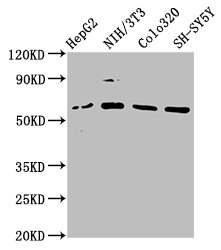 FBXW11 Antibody - Western Blot Positive WB detected in: HepG2 whole cell lysate, NIH/3T3 whole cell lysate, Colo320 whole cell lysate, SH-SY5Y whole cell lysate All lanes: FBXW11 antibody at 2.2µg/ml Secondary Goat polyclonal to rabbit IgG at 1/50000 dilution Predicted band size: 63, 59, 61 kDa Observed band size: 63 kDa
