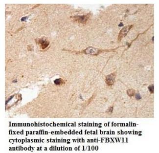 FBXW11 Antibody - Immunohistochemistry of FBXW11 antibody