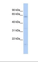 FBXW11 Antibody - 721_B cell lysate. Antibody concentration: 1.0 ug/ml. Gel concentration: 12%.  This image was taken for the unconjugated form of this product. Other forms have not been tested.