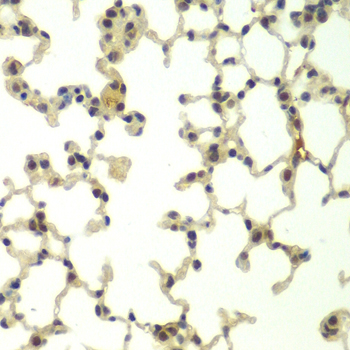 FBXW11 Antibody - Immunohistochemistry of paraffin-embedded mouse lung using FBXW11 antibody at dilution of 1:100 (40x lens).