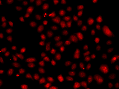 FBXW11 Antibody - Immunofluorescence blot of A549 cell using FBXW11 antibody.