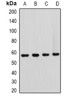 FBXW11 Antibody - Western blot analysis of HOS expression in HeLa (A); NIH3T3 (B); mouse brain (C); rat brain (D) whole cell lysates.