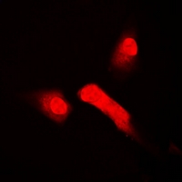 FBXW11 Antibody - Immunofluorescent analysis of HOS staining in A549 cells. Formalin-fixed cells were permeabilized with 0.1% Triton X-100 in TBS for 5-10 minutes and blocked with 3% BSA-PBS for 30 minutes at room temperature. Cells were probed with the primary antibody in 3% BSA-PBS and incubated overnight at 4 deg C in a humidified chamber. Cells were washed with PBST and incubated with a DyLight 594-conjugated secondary antibody (red) in PBS at room temperature in the dark.