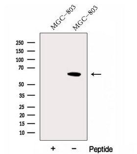 FBXW11 Antibody - Western blot analysis of extracts of MGC-803 cells using FBXW11 antibody. The lane on the left was treated with blocking peptide.