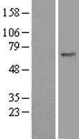 FBXW11 Protein - Western validation with an anti-DDK antibody * L: Control HEK293 lysate R: Over-expression lysate