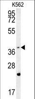 FBXW12 Antibody - FBXW12 Antibody western blot of K562 cell line lysates (35 ug/lane). The FBXW12 antibody detected the FBXW12 protein (arrow).