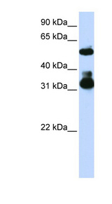 FBXW2 Antibody - FBXW2 antibody Western blot of Jurkat lysate. This image was taken for the unconjugated form of this product. Other forms have not been tested.