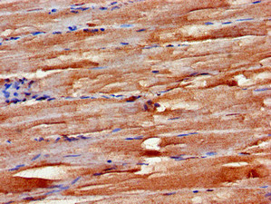 FBXW2 Antibody - Immunohistochemistry of paraffin-embedded human skeletal muscle tissue using FBXW2 Antibody at dilution of 1:100