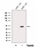 FBXW2 Antibody - Western blot analysis of extracts of HEK293 cells using FBXW2 antibody. The lane on the left was treated with blocking peptide.