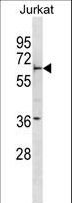FBXW5 Antibody - FBXW5 Antibody western blot of Jurkat cell line lysates (35 ug/lane). The FBXW5 antibody detected the FBXW5 protein (arrow).