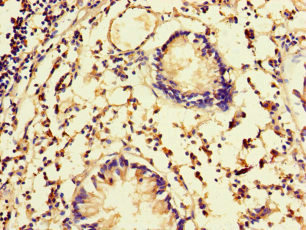 FBXW5 Antibody - Immunohistochemistry of paraffin-embedded human appendix tissue at dilution of 1:100