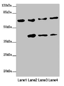 FBXW5 Antibody - Western blot All Lanes :FBXW5 antibody at 2 ug/ml Lane 1 : PC-3 whole cell lysate Lane 2 : Jurkat whole cell lysate Lane 3 : Hela whole cell lysate Lane 4 : 293T whole cell lysate Secondary Goat polyclonal to rabbit IgG at 1/10000 dilution Predicted band size: 64,43 kDa Observed band size: 64,41 kDa
