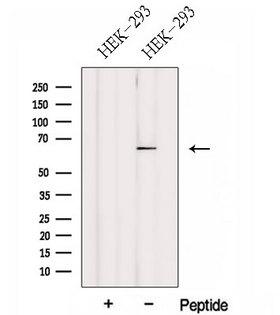 FBXW5 Antibody - Western blot analysis of extracts of HEK293 cells using FBXW5 antibody. The lane on the left was treated with blocking peptide.