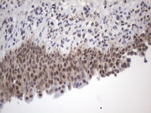 FBXW7 / FBW7 Antibody - IHC of paraffin-embedded Human bladder tissue using anti-FBXW7 mouse monoclonal antibody. (Heat-induced epitope retrieval by 1 mM EDTA in 10mM Tris, pH8.5, 120°C for 3min).