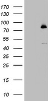 FBXW7 / FBW7 Antibody - HEK293T cells were transfected with the pCMV6-ENTRY control (Left lane) or pCMV6-ENTRY FBXW7 (Right lane) cDNA for 48 hrs and lysed. Equivalent amounts of cell lysates (5 ug per lane) were separated by SDS-PAGE and immunoblotted with anti-FBXW7.