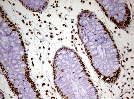 FBXW7 / FBW7 Antibody - IHC of paraffin-embedded Human colon tissue using anti-FBXW7 mouse monoclonal antibody. (Heat-induced epitope retrieval by 10mM citric buffer, pH6.0, 120°C for 3min).