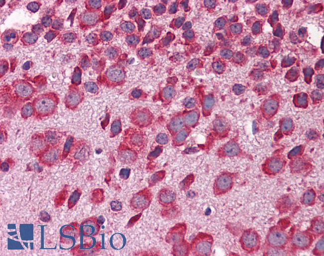 FBXW7 / FBW7 Antibody - Anti-FBXW7 antibody IHC of mouse brain. Immunohistochemistry of formalin-fixed, paraffin-embedded tissue after heat-induced antigen retrieval. Antibody concentration 5 ug/ml.  This image was taken for the unconjugated form of this product. Other forms have not been tested.