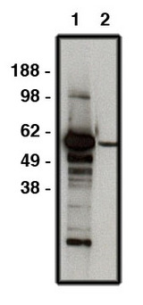 FBXW7 / FBW7 Antibody - Western blot of FBXW7 antibody on human brain lysate (15 ug/lane). Antibody used at 10 ug/ml (1) and 1 ug/ml (2). Secondary antibody, mouse anti-rabbit HRP used at 1:50k dilution.