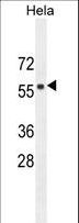FBXW8 Antibody - FBXW8 Antibody western blot of HeLa cell line lysates (35 ug/lane). The FBXW8 antibody detected the FBXW8 protein (arrow).