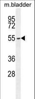 FBXW8 Antibody - FBXW8 Antibody western blot of mouse bladder tissue lysates (35 ug/lane). The FBXW8 antibody detected the FBXW8 protein (arrow).