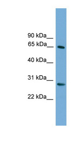 FBXW8 Antibody - FBXW8 antibody Western blot of ACHN lysate. This image was taken for the unconjugated form of this product. Other forms have not been tested.