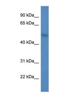 FBXW9 Antibody - FBXW9 antibody Western blot of HepG2 Cell lysate. Antibody concentration 1 ug/ml.  This image was taken for the unconjugated form of this product. Other forms have not been tested.