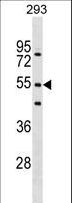 FBXW9 Antibody - FBXW9 Antibody western blot of 293 cell line lysates (35 ug/lane). The FBXW9 antibody detected the FBXW9 protein (arrow).