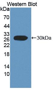 FCAR / CD89 Antibody - Western blot of FCAR / CD89 antibody.