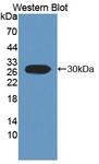 FCAR / CD89 Antibody - Western blot of FCAR / CD89 antibody.