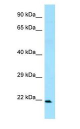 FCAR / CD89 Antibody - FCAR / CD89 antibody Western Blot of Placenta.  This image was taken for the unconjugated form of this product. Other forms have not been tested.