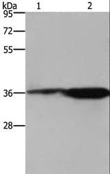 FCAR / CD89 Antibody - Western blot analysis of 293T cell and mouse brain tissue, using FCAR Polyclonal Antibody at dilution of 1:550.