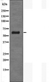 FCAR / CD89 Antibody - Western blot analysis FCAR using LOVO cells whole cells lysates