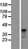 FCAR / CD89 Protein - Western validation with an anti-DDK antibody * L: Control HEK293 lysate R: Over-expression lysate