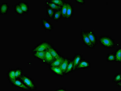 FCER1G Antibody - Immunofluorescent analysis of HepG2 cells using FCER1G Antibody at dilution of 1:100 and Alexa Fluor 488-congugated AffiniPure Goat Anti-Rabbit IgG(H+L)