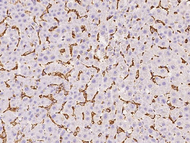 FCER1G Antibody - Immunochemical staining of human FCER1G in human liver with rabbit polyclonal antibody at 1:10000 dilution, formalin-fixed paraffin embedded sections.