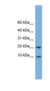 FCER1G Antibody - FCER1G antibody Western blot of HeLa lysate. This image was taken for the unconjugated form of this product. Other forms have not been tested.