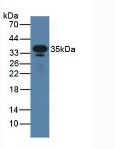 FCER2 / CD23 Antibody - Western Blot; Sample: Mouse Serum.