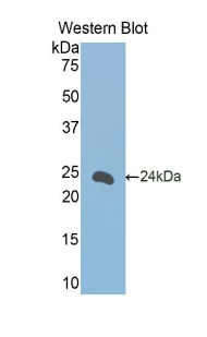 FCER2 / CD23 Antibody - Western blot of recombinant FCER2 / CD23.  This image was taken for the unconjugated form of this product. Other forms have not been tested.