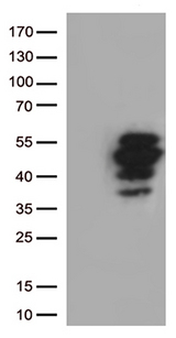 FCER2 / CD23 Antibody - HEK293T cells were transfected with the pCMV6-ENTRY control. (Left lane) or pCMV6-ENTRY FCER2. (Right lane) cDNA for 48 hrs and lysed. Equivalent amounts of cell lysates. (5 ug per lane) were separated by SDS-PAGE and immunoblotted with anti-FCER2. (1:2000)