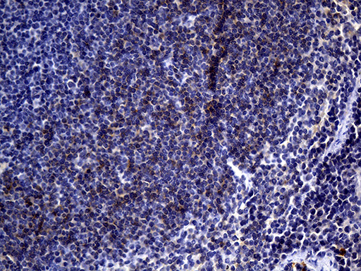 FCER2 / CD23 Antibody - Immunohistochemical staining of paraffin-embedded mouse spleen tissue within the normal limits using anti-FCER2 mouse monoclonal antibody. (Heat-induced epitope retrieval by 1mM EDTA in 10mM Tris buffer. (pH8.5) at 120 oC for 3 min. (1:500)
