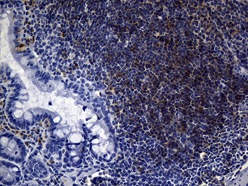 FCER2 / CD23 Antibody - Immunohistochemical staining of paraffin-embedded mouse ascending colon tissue within the normal limits using anti-CD23 mouse monoclonal antibody. (Heat-induced epitope retrieval by 1mM EDTA in 10mM Tris buffer. (pH8.5) at 120? for 3 min. (1:500)