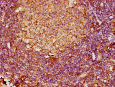 FCER2 / CD23 Antibody - IHC image of FCER2 Antibody diluted at 1:800 and staining in paraffin-embedded human lymph node tissue performed on a Leica BondTM system. After dewaxing and hydration, antigen retrieval was mediated by high pressure in a citrate buffer (pH 6.0). Section was blocked with 10% normal goat serum 30min at RT. Then primary antibody (1% BSA) was incubated at 4°C overnight. The primary is detected by a biotinylated secondary antibody and visualized using an HRP conjugated SP system.
