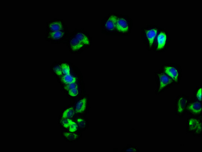 FCER2 / CD23 Antibody - Immunofluorescence staining of PC3 cells with FCER2 Antibody at 1:166, counter-stained with DAPI. The cells were fixed in 4% formaldehyde, permeabilized using 0.2% Triton X-100 and blocked in 10% normal Goat Serum. The cells were then incubated with the antibody overnight at 4°C. The secondary antibody was Alexa Fluor 488-congugated AffiniPure Goat Anti-Rabbit IgG(H+L).