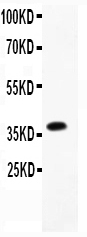 FCER2 / CD23 Antibody - Western blot - Anti-CD23/FCER2 Antibody
